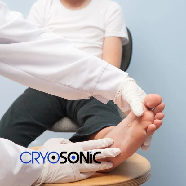 Are you looking for fast effective wart removal Contact us today Coventry
